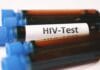 Test na HIV po ekspozycji: okienko serologiczne i różnice między testem IV generacji a PCR Test na HIV po ekspozycji: okienko serologiczne i różnice między testem IV generacji a PCR