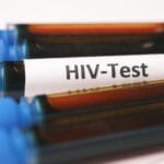 Test na HIV po ekspozycji: okienko serologiczne i różnice między testem IV generacji a PCR