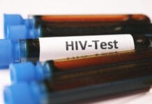 Test na HIV po ekspozycji: okienko serologiczne i różnice między testem IV generacji a PCR Test na HIV po ekspozycji: okienko serologiczne i różnice między testem IV generacji a PCR