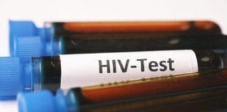 Test na HIV po ekspozycji: okienko serologiczne i różnice między testem IV generacji a PCR