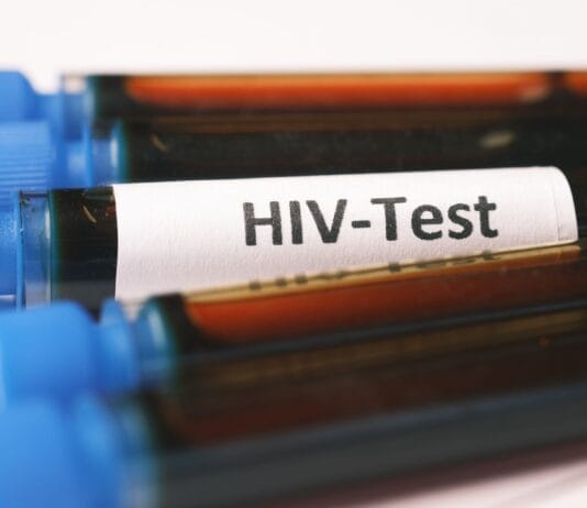 Test na HIV po ekspozycji: okienko serologiczne i różnice między testem IV generacji a PCR Test na HIV po ekspozycji: okienko serologiczne i różnice między testem IV generacji a PCR