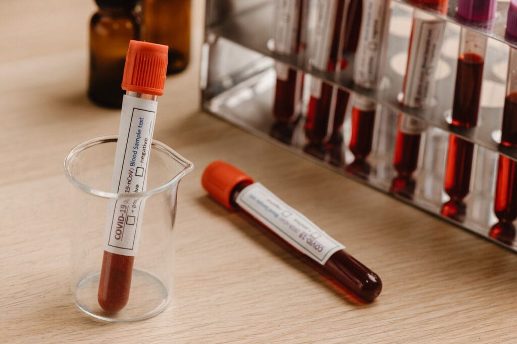 Test na HIV po ekspozycji: okienko serologiczne i różnice między testem IV generacji a PCR