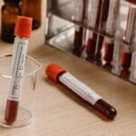 Test na HIV po ekspozycji: okienko serologiczne i różnice między testem IV generacji a PCR